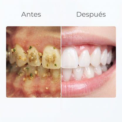 AquaJet Oral™+ Pack de 4 Boquillas de Regalo